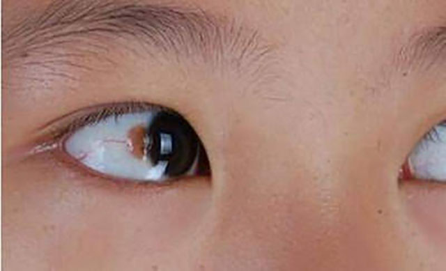 百合型指甲算命_最丑的眼型是什么眼型_眼型算命