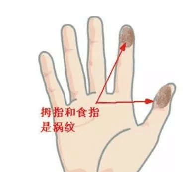 拇指和食指上有“斗”的人有何命运特征？