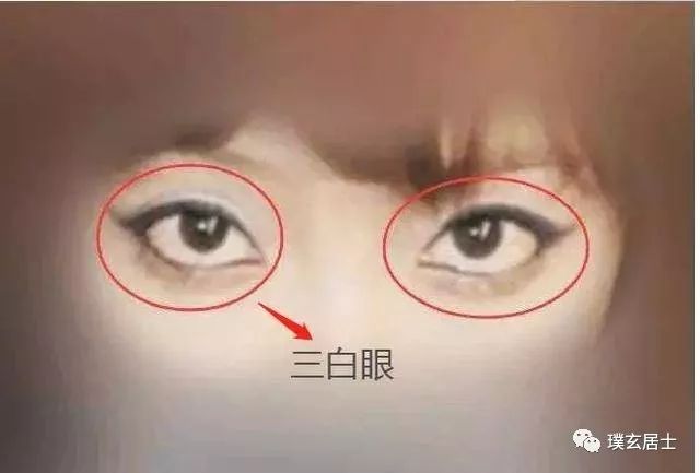 眼型算命_豆豆眼什么眼型_最丑的眼型是什么眼型